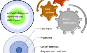 Ai saving lives cancer detection study yes