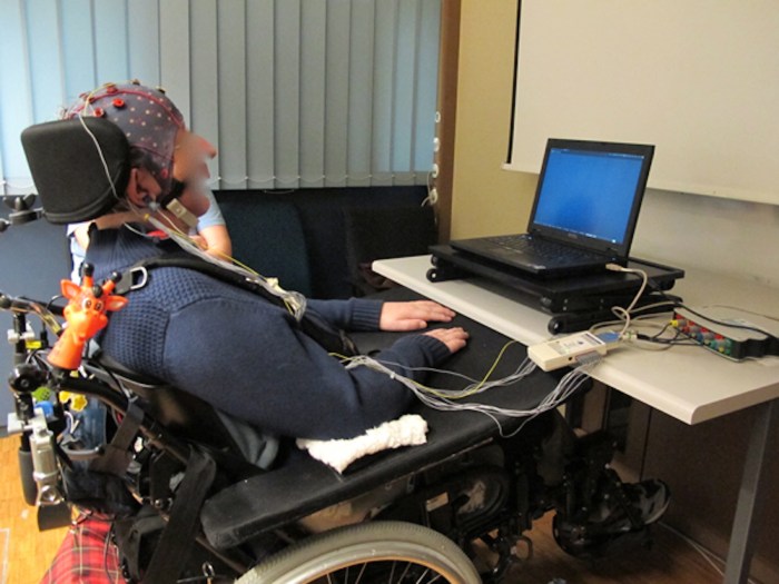 Brain interface computer interfaces machine cerebral palsy control intechopen challenges improve figure devices