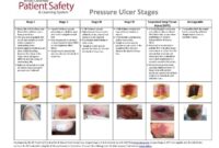 Staging pain why you shouldnt skip it