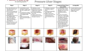 Staging pain why you shouldnt skip it