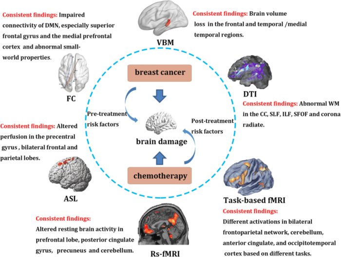 European mri study provides experimental evidence indicating the human brain quantum