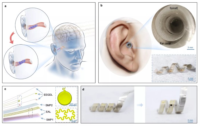 Dutch startup tests hearing via brain computer interface