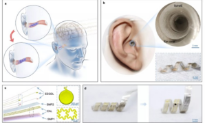 Dutch startup tests hearing via brain computer interface